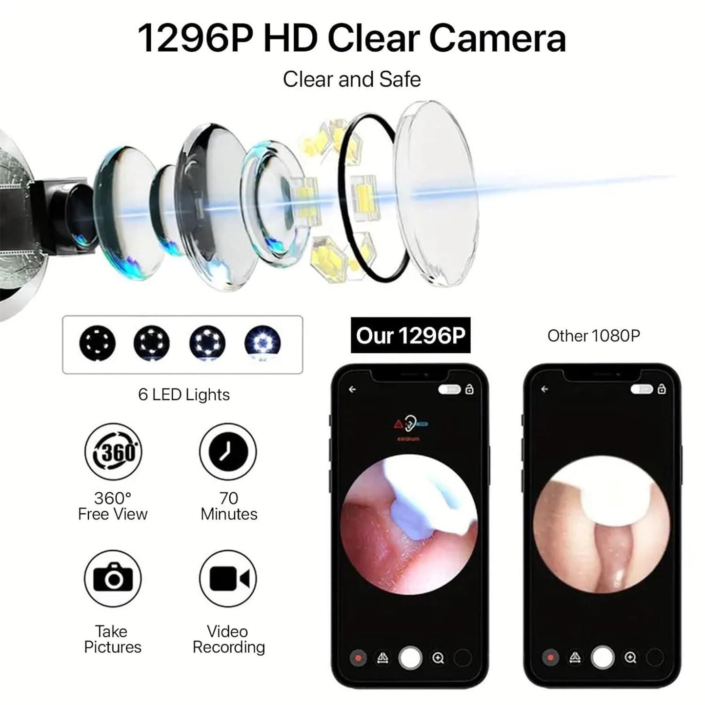 Smart Visual Ear Wax Cleaner with HD Camera